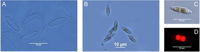 Photoacclimation to Constant and Changing Light Conditions in a Benthic Diatom